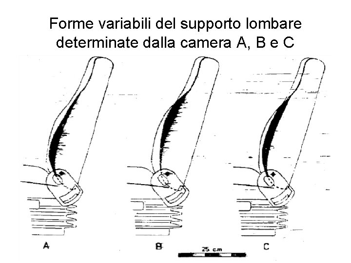 Forme variabili del supporto lombare determinate dalla camera A, B e C 