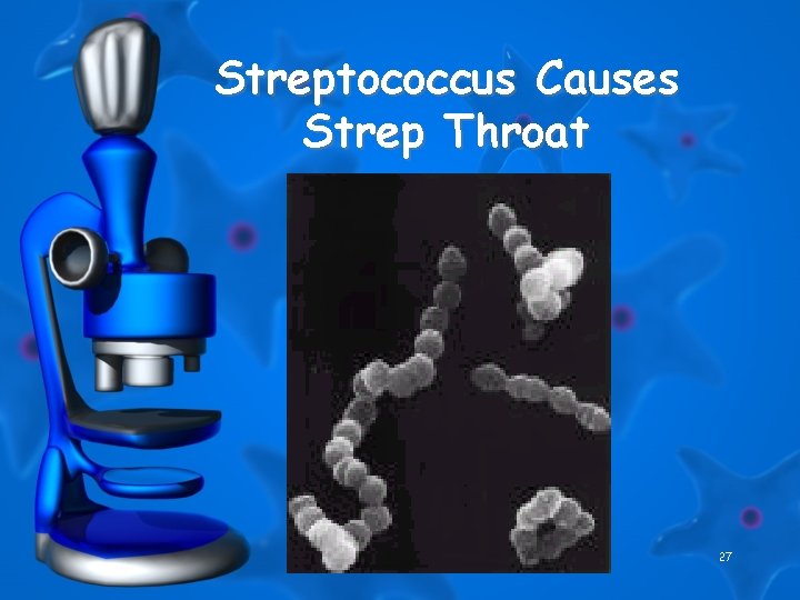 Streptococcus Causes Strep Throat 27 