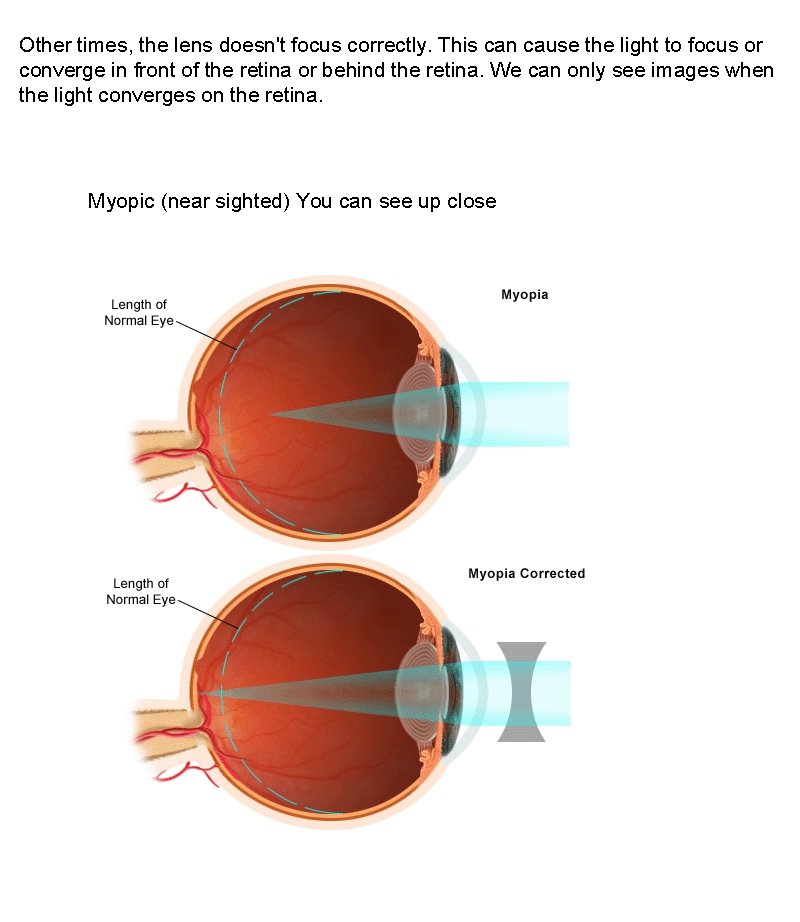 Other times, the lens doesn't focus correctly. This can cause the light to focus