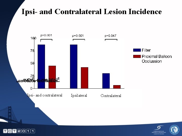 Ipsi- and Contralateral Lesion Incidence Ipsi- and contralateral Ipsilateral Contralateral 