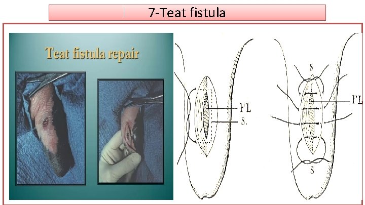 7 -Teat fistula 