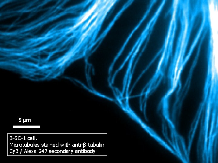 5 μm B-SC-1 cell, Microtubules stained with anti-β tubulin Cy 3 / Alexa 647