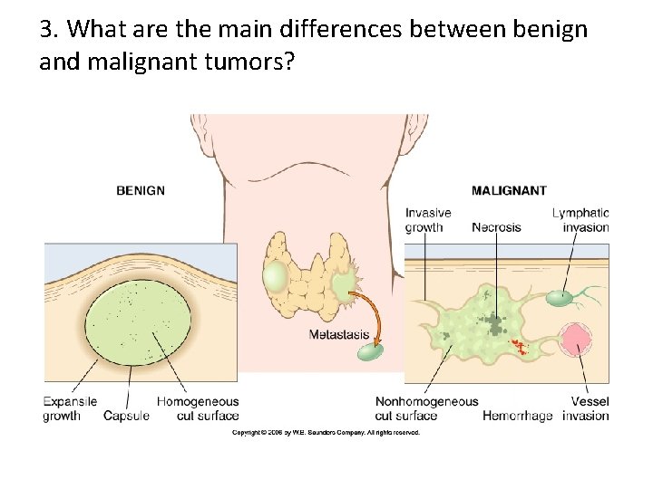 3. What are the main differences between benign and malignant tumors? 3. What are the main differences between benign and malignant tumors?