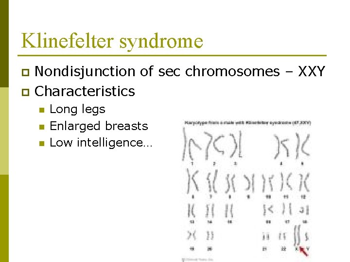 Klinefelter syndrome Nondisjunction of sec chromosomes – XXY p Characteristics p n n n