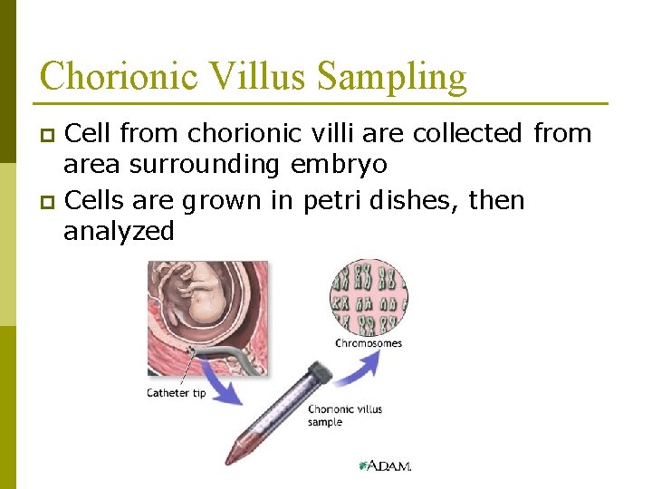 Chorionic Villus Sampling Cell from chorionic villi are collected from area surrounding embryo p