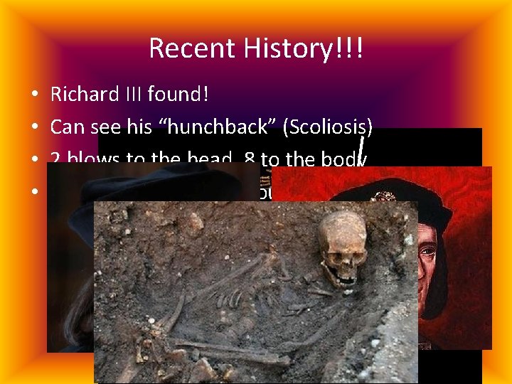 Recent History!!! • • Richard III found! Can see his “hunchback” (Scoliosis) 2 blows