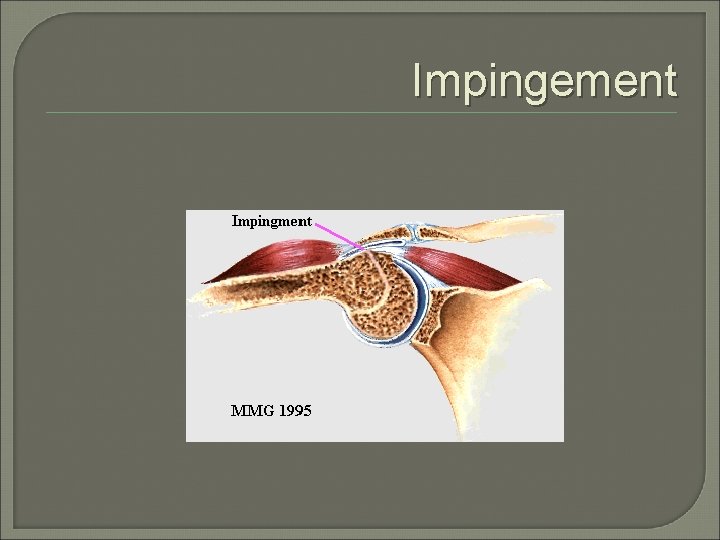 Impingement 