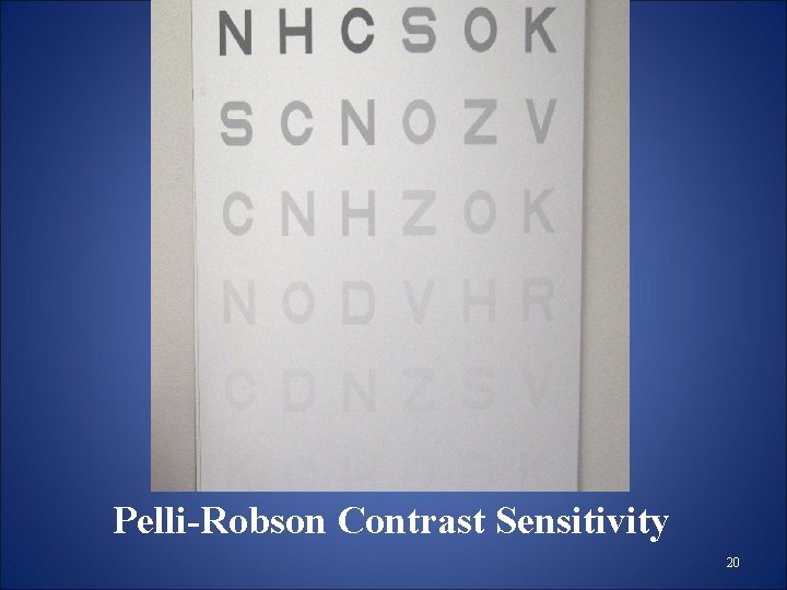 Pelli-Robson Contrast Sensitivity 20 Pelli-Robson Contrast Sensitivity 20