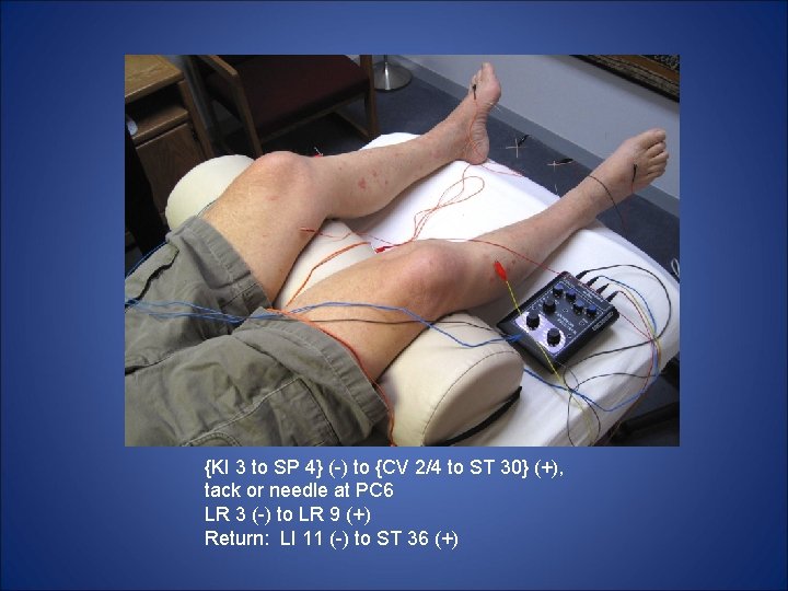 {KI 3 to SP 4} (-) to {CV 2/4 to ST 30} (+), tack {KI 3 to SP 4} (-) to {CV 2/4 to ST 30} (+), tack
