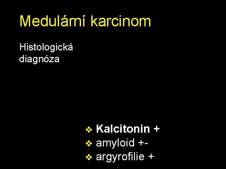 Medulární karcinom Histologická diagnóza Kalcitonin + v amyloid +v argyrofilie + v 