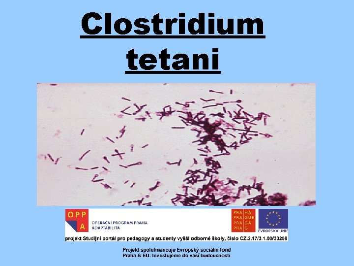 Clostridium tetani 