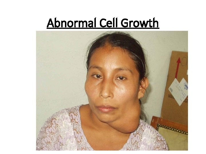 Abnormal Cell Growth 