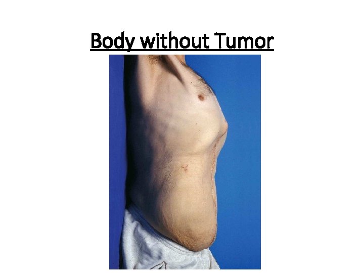 Body without Tumor 