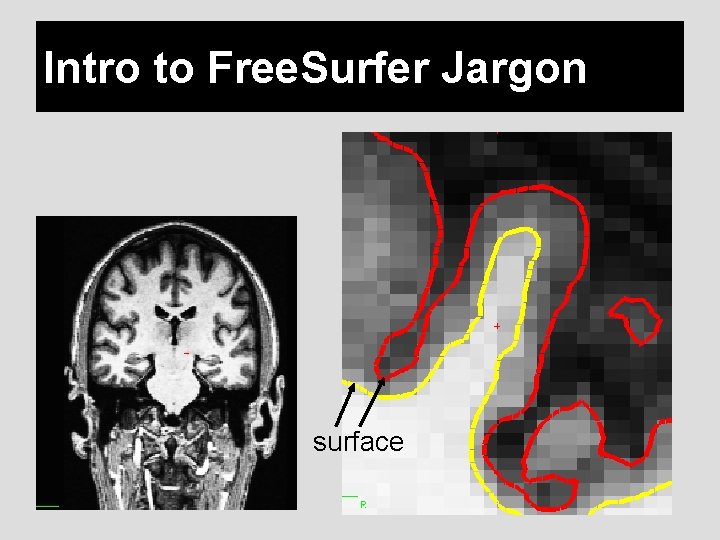 Intro to Free. Surfer Jargon surface 