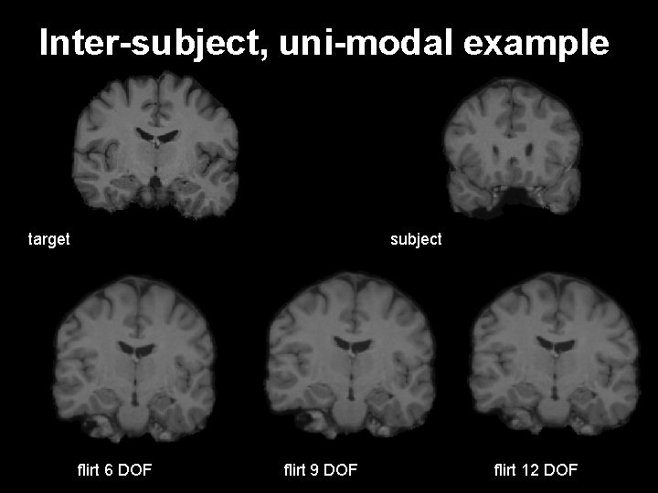 Inter-subject, uni-modal example target subject flirt 6 DOF flirt 9 DOF flirt 12 DOF