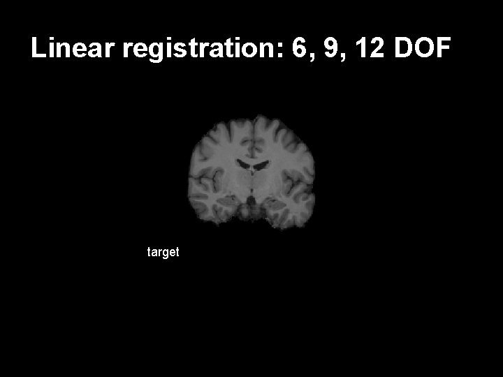 Linear registration: 6, 9, 12 DOF target subject Flirt 9 12 DOF 6 