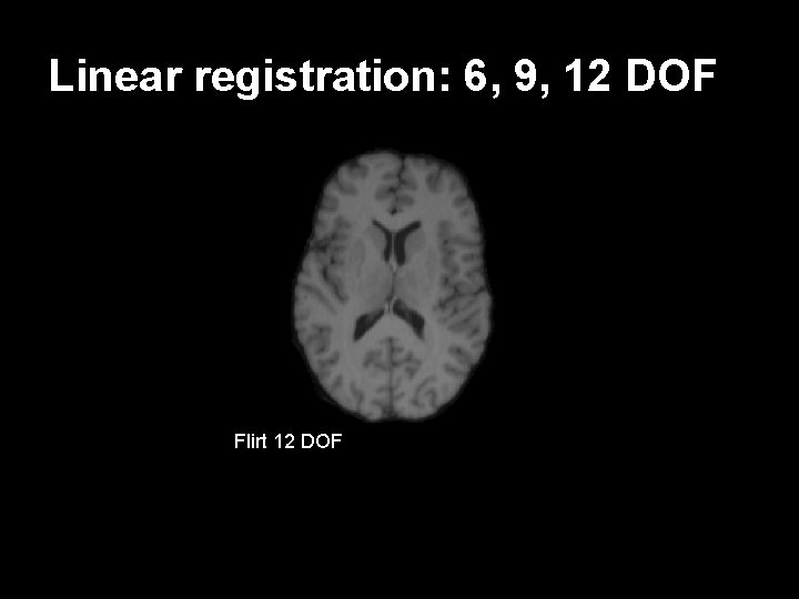 Linear registration: 6, 9, 12 DOF Flirt 12 9 DOF subject Flirt DOF target