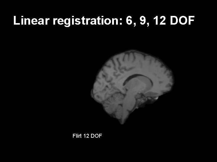 Linear registration: 6, 9, 12 DOF Flirt 6 DOF target Flirt 129 subject 