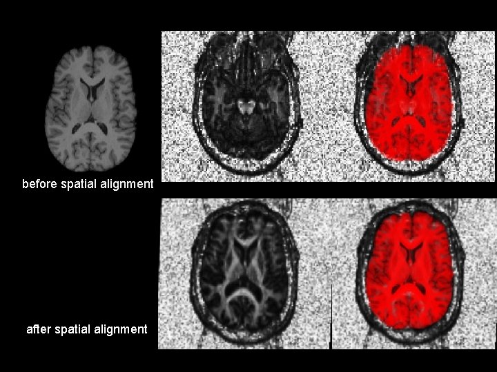 before spatial alignment after spatial alignment 