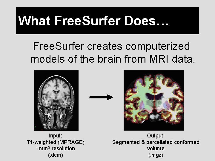 What Free. Surfer Does… Free. Surfer creates computerized models of the brain from MRI