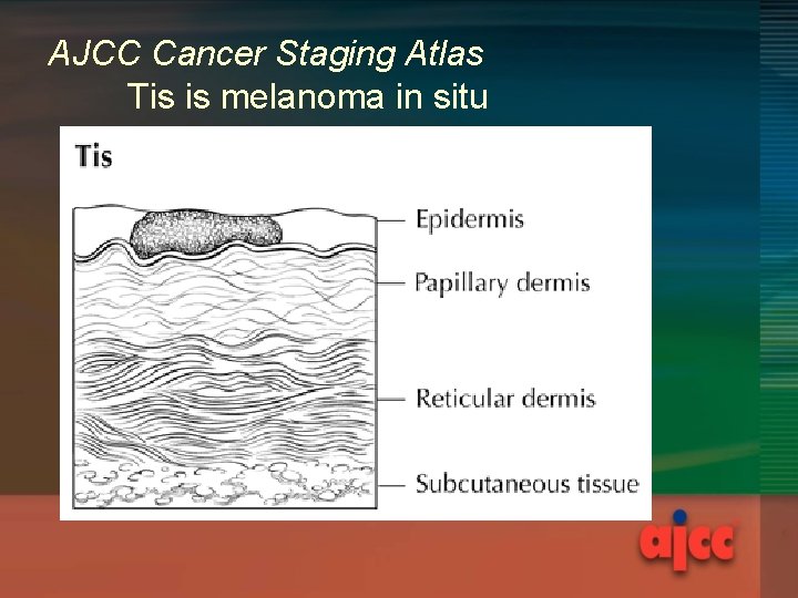 AJCC Cancer Staging Atlas Tis is melanoma in situ 