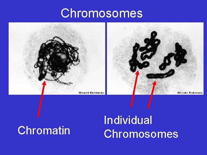 Chromosomes Chromatin Individual Chromosomes Chromosomes Chromatin Individual Chromosomes
