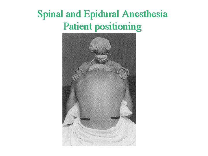 Spinal and Epidural Anesthesia Patient positioning 