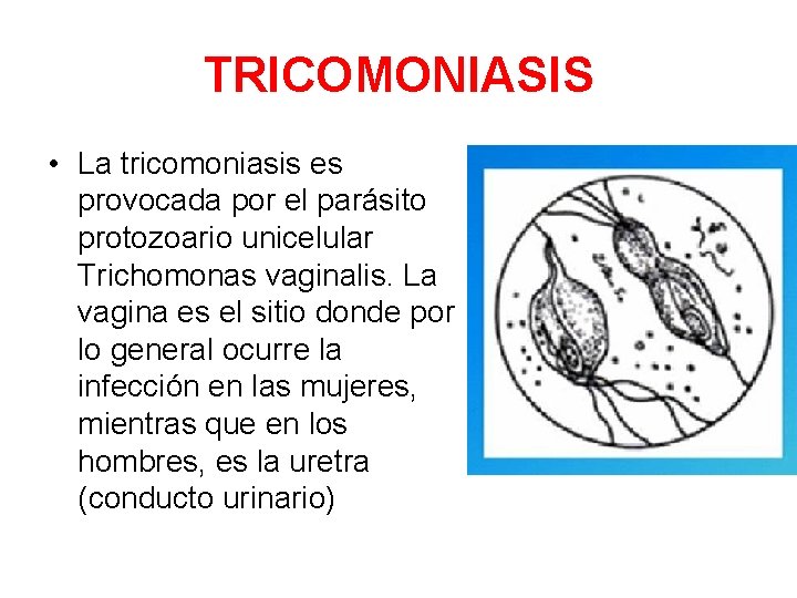 TRICOMONIASIS • La tricomoniasis es provocada por el parásito protozoario unicelular Trichomonas vaginalis. La