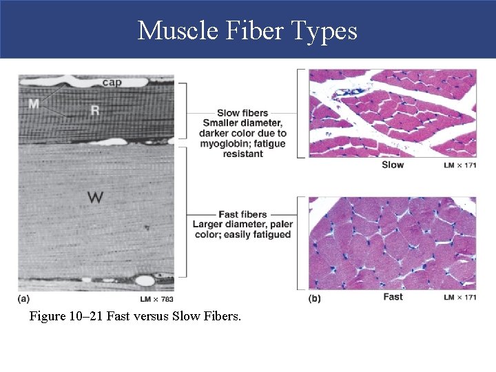Muscle Fiber Types Figure 10– 21 Fast versus Slow Fibers. 