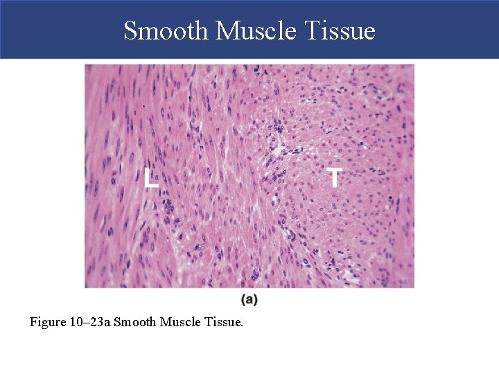 Smooth Muscle Tissue Figure 10– 23 a Smooth Muscle Tissue. 