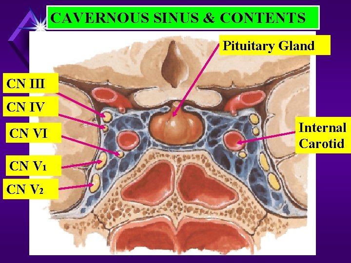 CAVERNOUS SINUS & CONTENTS Pituitary Gland CN III CN IV CN VI CN V