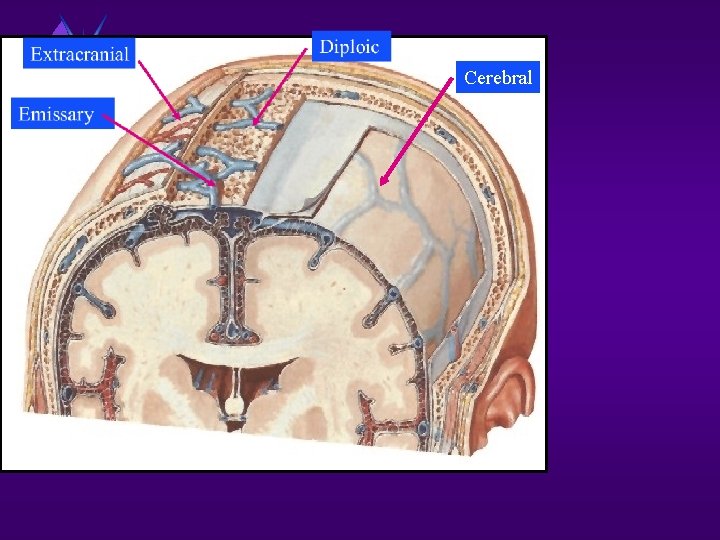 Cerebral 