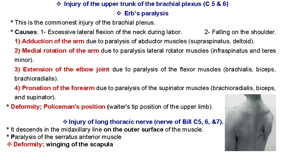 v Injury of the upper trunk of the brachial plexus (C 5 & 6) v Injury of the upper trunk of the brachial plexus (C 5 & 6)