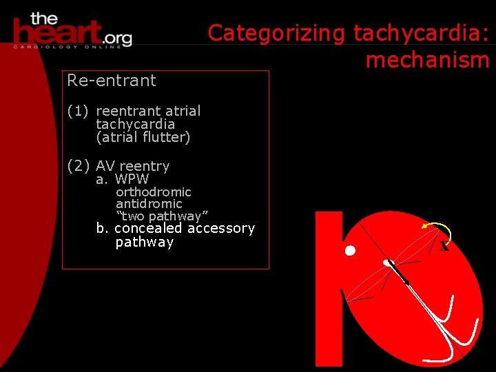 Re-entrant Categorizing tachycardia: mechanism (1) reentrant atrial tachycardia (atrial flutter) (2) AV reentry a.