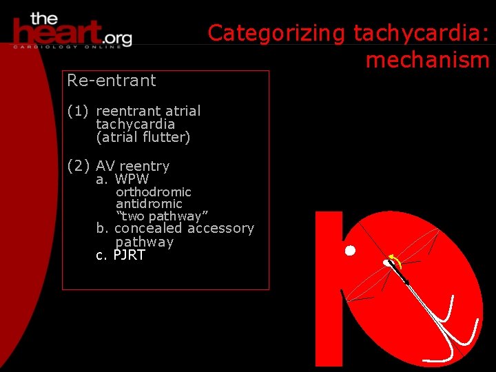 Re-entrant Categorizing tachycardia: mechanism (1) reentrant atrial tachycardia (atrial flutter) (2) AV reentry a.