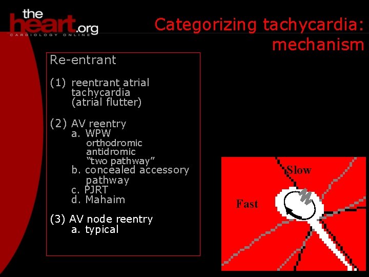 Re-entrant Categorizing tachycardia: mechanism (1) reentrant atrial tachycardia (atrial flutter) (2) AV reentry a.