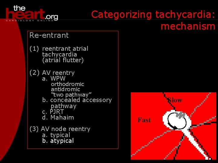 Re-entrant Categorizing tachycardia: mechanism (1) reentrant atrial tachycardia (atrial flutter) (2) AV reentry a.