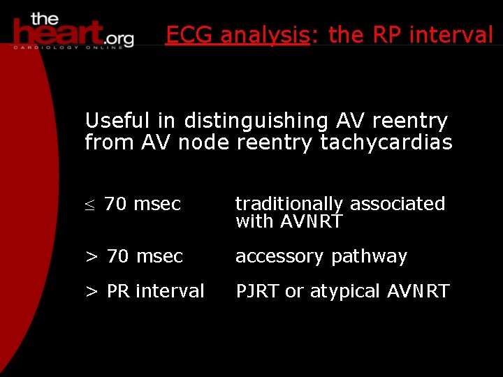 ECG analysis: the RP interval Useful in distinguishing AV reentry from AV node reentry