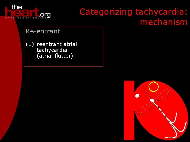 Categorizing tachycardia: mechanism Re-entrant (1) reentrant atrial tachycardia (atrial flutter) 