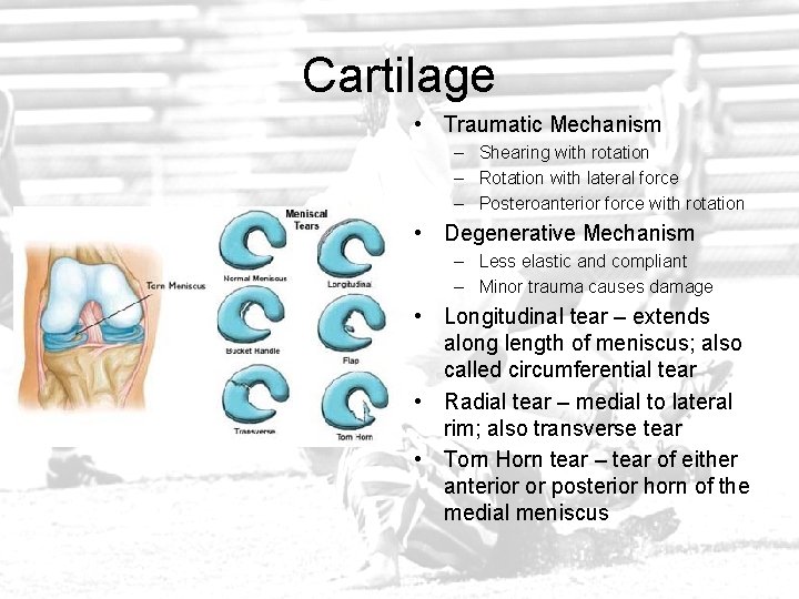 Cartilage • Traumatic Mechanism – Shearing with rotation – Rotation with lateral force –