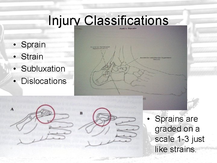 Injury Classifications • • Sprain Strain Subluxation Dislocations • Sprains are graded on a
