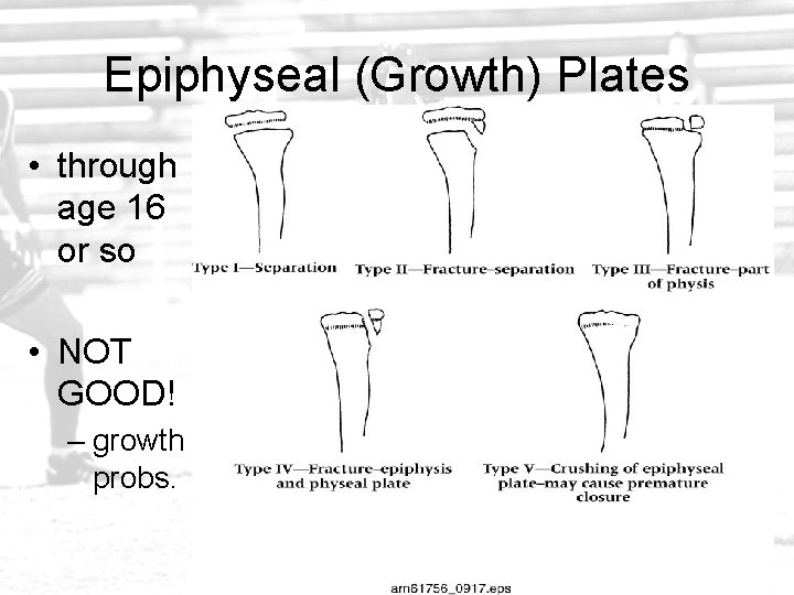 Epiphyseal (Growth) Plates • through age 16 or so • NOT GOOD! – growth