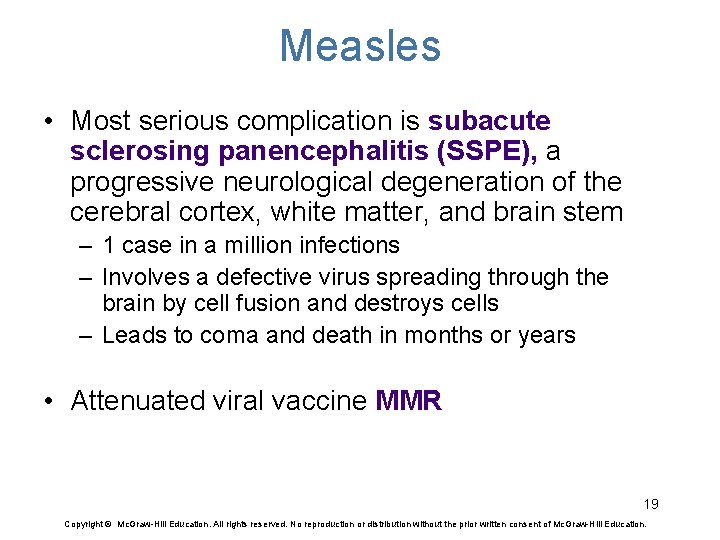 Measles • Most serious complication is subacute sclerosing panencephalitis (SSPE), a progressive neurological degeneration