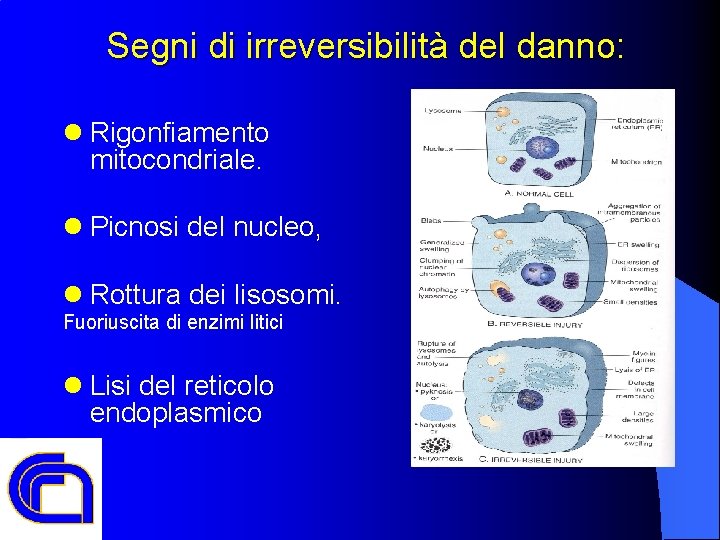 Segni di irreversibilità del danno: l Rigonfiamento mitocondriale. l Picnosi del nucleo, l Rottura