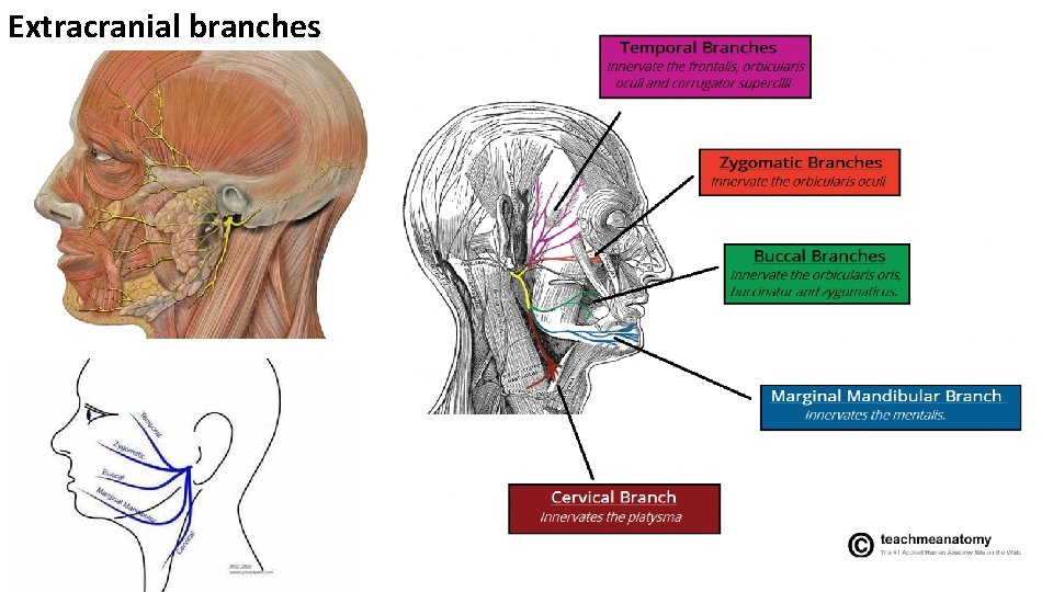 Extracranial branches 