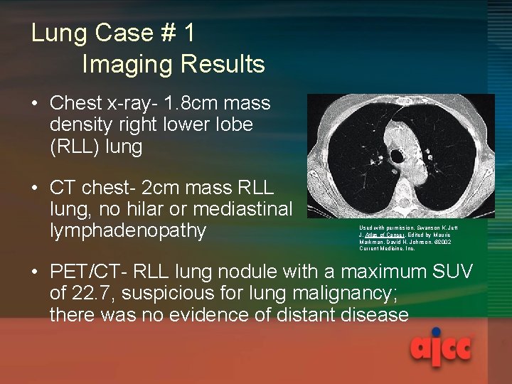 Lung Case # 1 Imaging Results • Chest x-ray- 1. 8 cm mass density