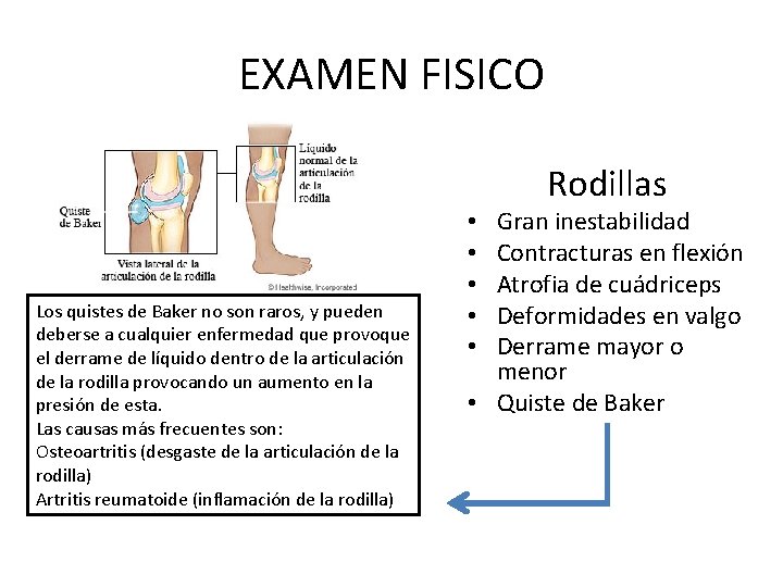 EXAMEN FISICO Los quistes de Baker no son raros, y pueden deberse a cualquier