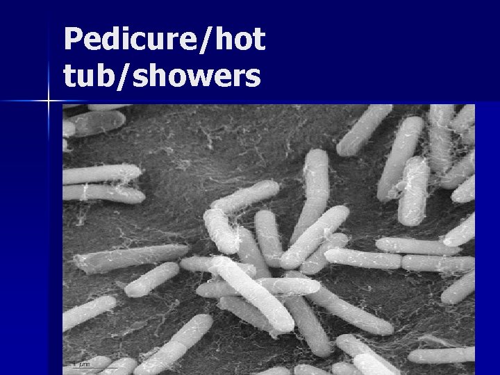 Pedicure/hot tub/showers bacilli Pedicure/hot tub/showers bacilli