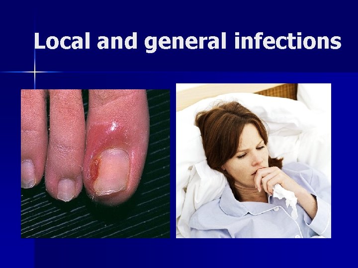 Local and general infections Local and general infections