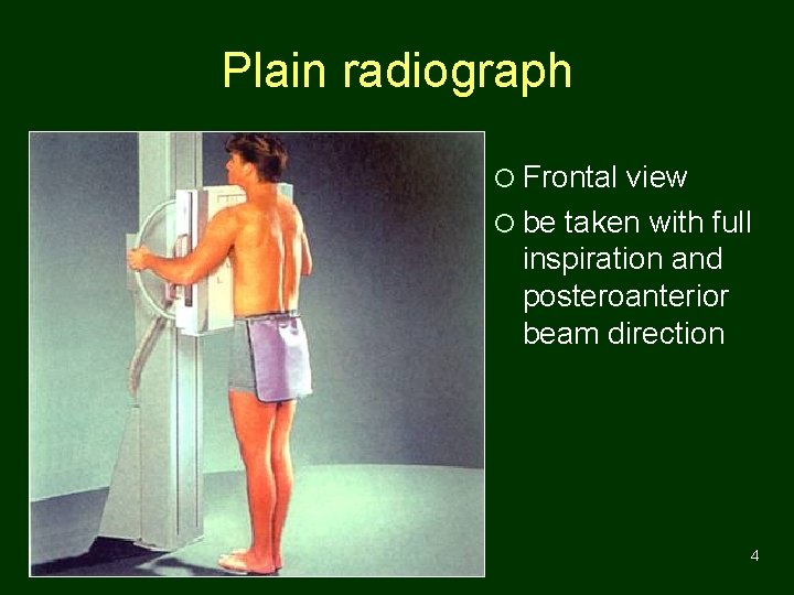 Plain radiograph ¡ Frontal view ¡ be taken with full inspiration and posteroanterior beam